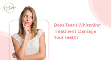 Read more about the article Do Teeth Whitening Treatment Damage Your Teeth?